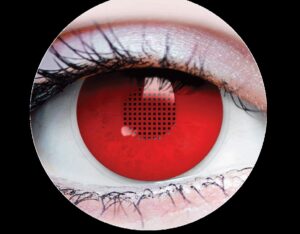 X-Ray Contacts